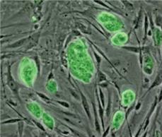 Scientists can now extract stem cells from amniotic fluid ()